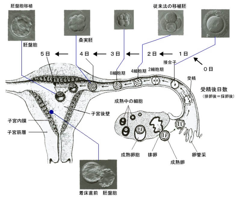 ivf%e8%aa%ac%e6%98%8e